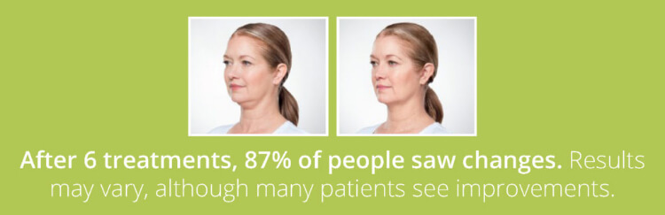 After 6 treatments, 87% of people saw changes. 